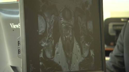 Doctors urging men to take preventative care with health