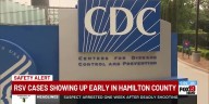 RSV cases showing up early in Hamilton County