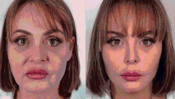Gaby Spanic reaparece con impactante rejuvenecimiento tras tratamiento estético en Brasil