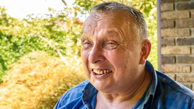 Plastic surgeons overwhelmed with requests for coveted 'Wigan face'