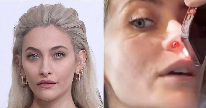 Paris Jackson Reveals HOLE Inside Her Nose After Years Of Drug Abuse
