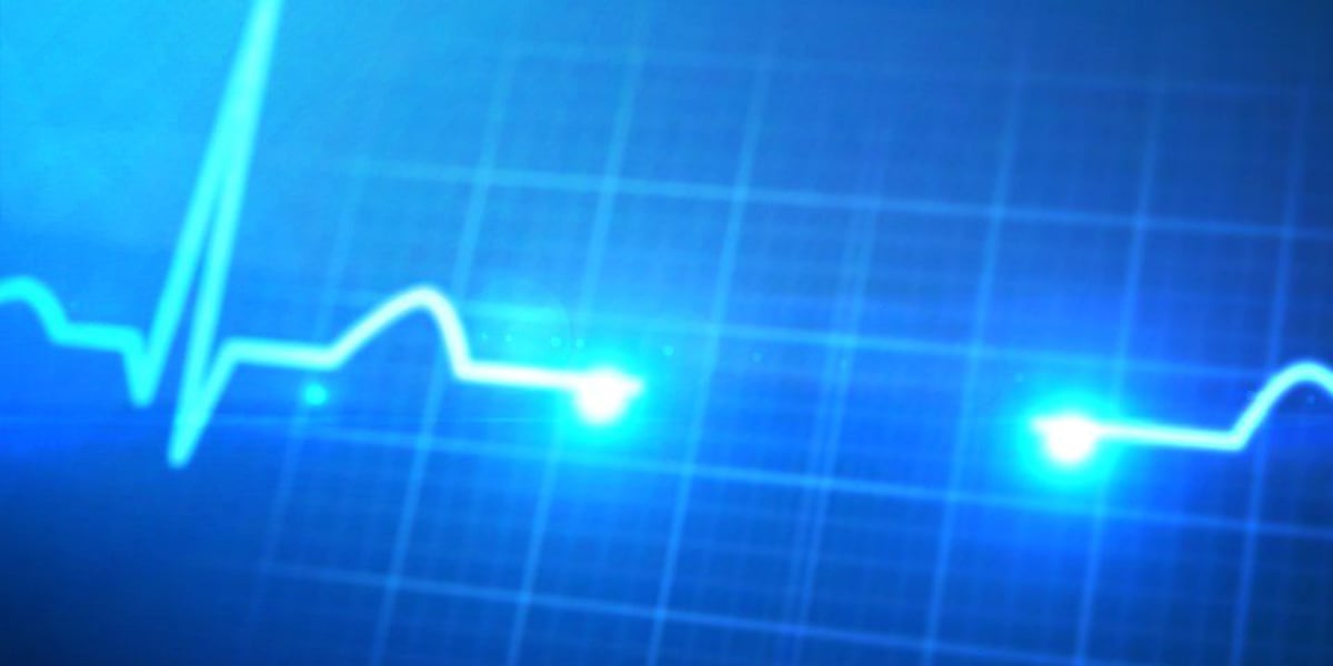 Holiday Heart Syndrome not as festive as the name suggests