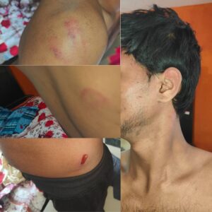 Mystery Surrounds Death of Andaman Youth in Bengaluru; Family Alleges Foul Play