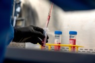 Lifelong drugs for autoimmune diseases don't work well. Now scientists are trying something new