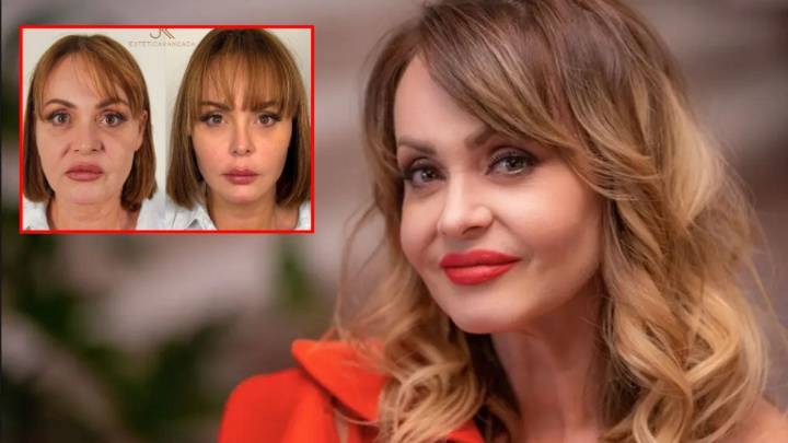 Gaby Spanic sorprende con drástica transformación tras someterse a procedimientos estéticos