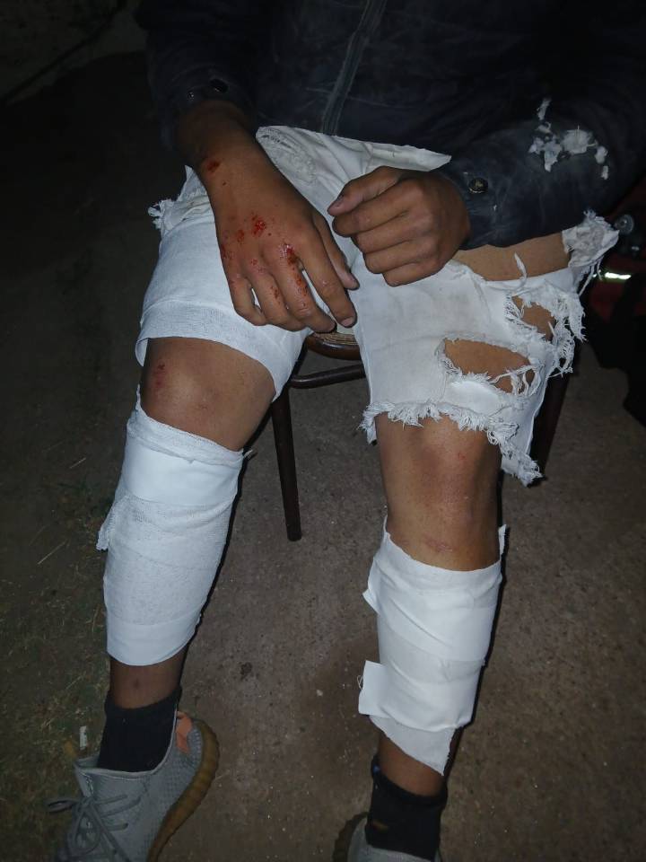 Un menor resultó herido tras caer de su moto al evadir un control policial en la Ruta 38