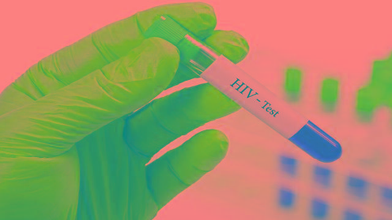 Crisis global del VIH se agrava por recortes de ayuda internacional, alerta ONU SIDA