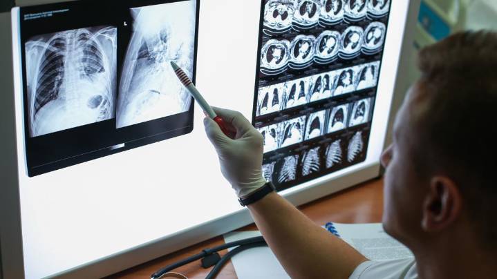 Living with COPD: What it is and options for relief