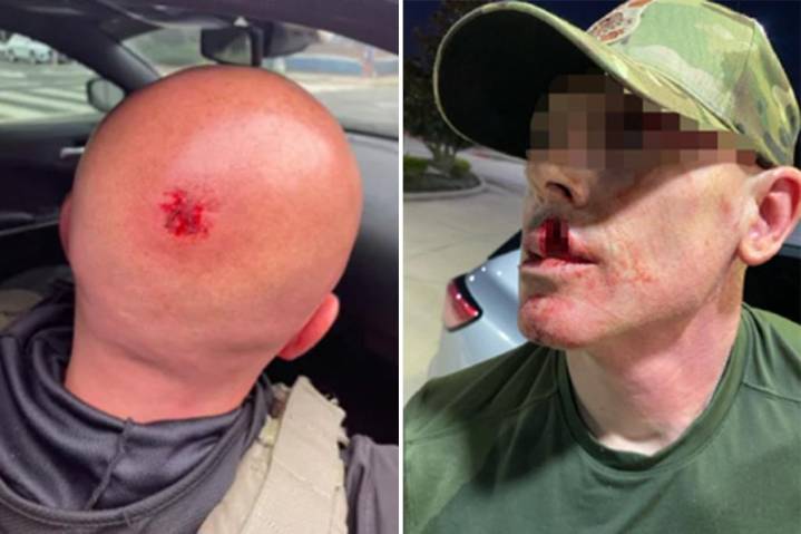 Exclusive | Assaults on ICE agents skyrocket 1,150% since Trump took office