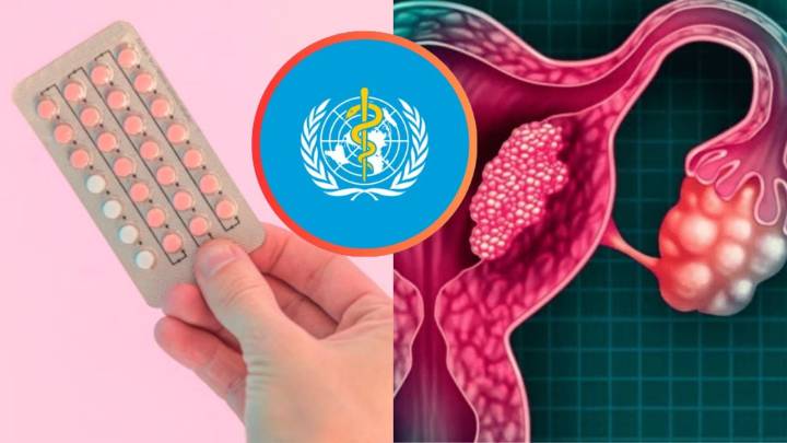 ¿La píldora anticonceptiva es cancerígena? La OMS revela la respuesta en estudio