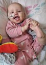 Baby’s ‘ordinary cold’ turns out to be rare blood cancer
