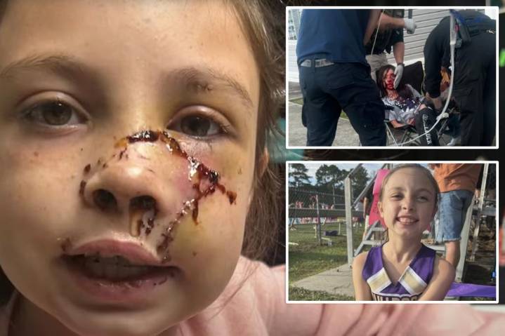 Alabama girl, 9, mauled by dog that 'grabbed' her face, leaving brutal injuries