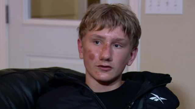 14-year-old boy recovering from attack at an Elk Grove school