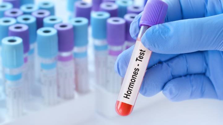 Are your hormones imbalanced? Doctors explain how to know if you need testing