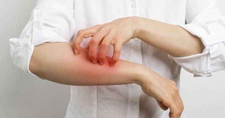 College confirms outbreak of Victorian-era disease as parents warned 'it needs to be treated'