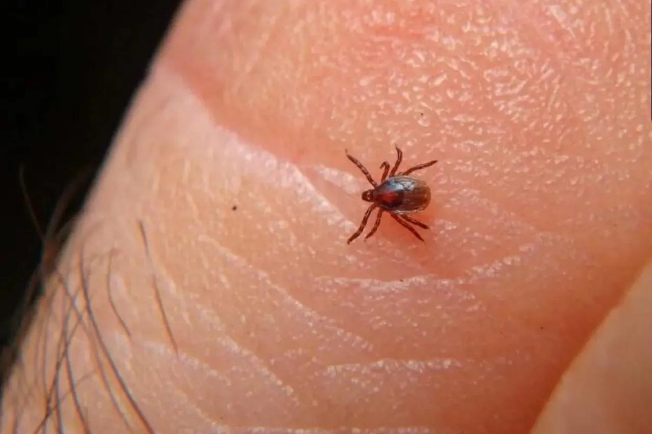 Suma Chihuahua más de 100 casos de Rickettsiosis