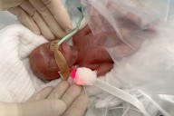 Baby Born Weighing Less Than 1 Lb. Comes Home 9 Weeks After Due Date