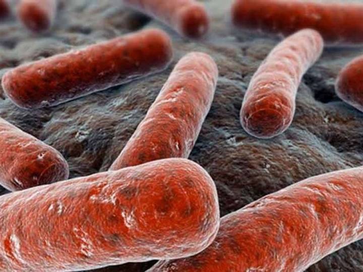 Casos de tuberculosis bajan por primera vez desde pandemia, pero hay 1.23 millones de muertes