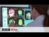 Adolescence lasts into 30s, new study shows