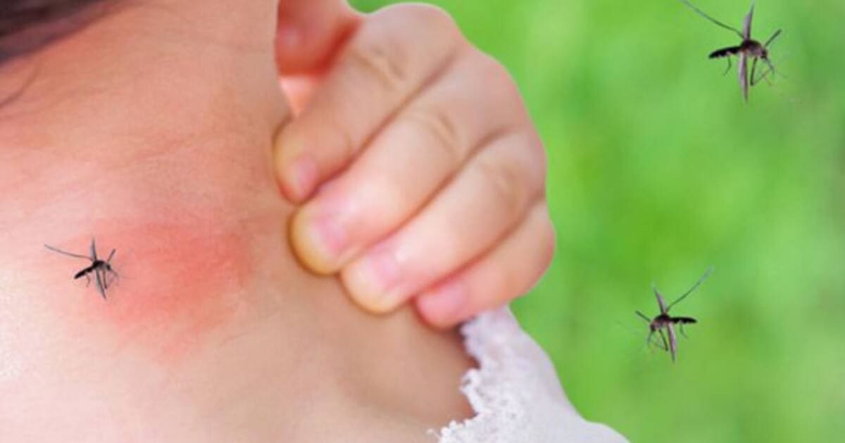 Alerta por muerte de niña en Floridablanca, presuntamente por dengue