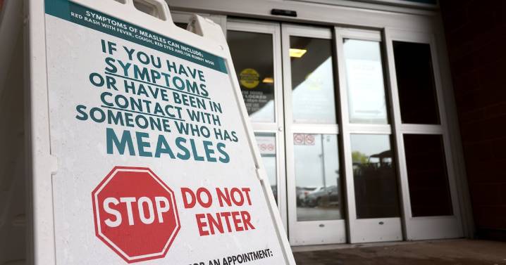 Canada measles: What you need to get elimination status