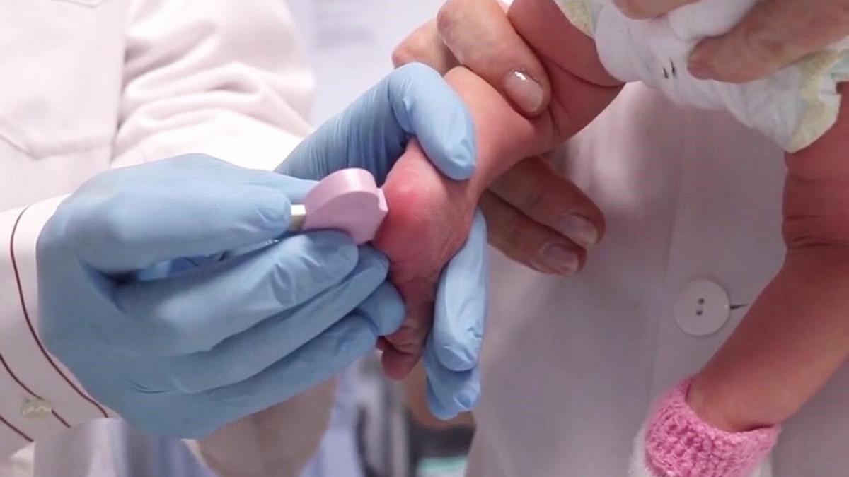 Sanidad acuerda con las comunidades ampliar el cribado de cáncer de colon a los 74 años