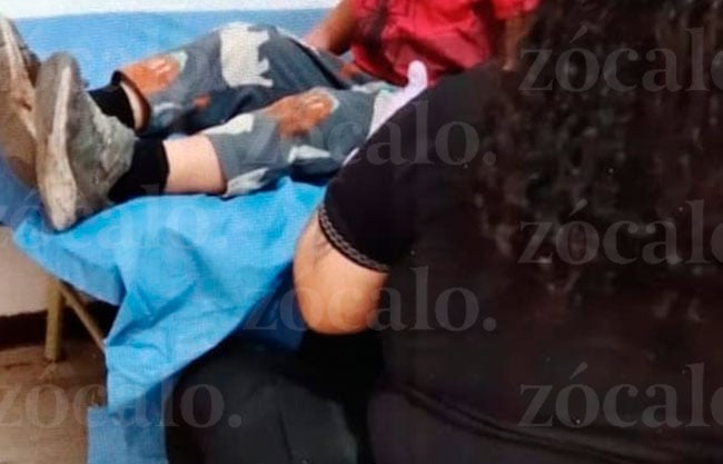 Ataca perro a niño de cuatro años en Piedras Negras