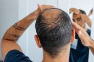 How does the hair-loss drug finasteride work? Can it affect my mental health?