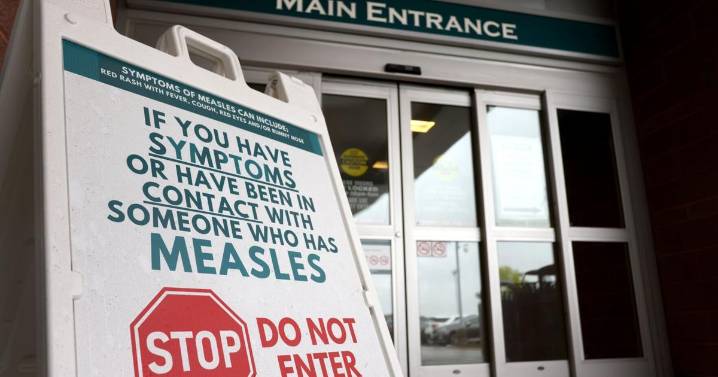 Canada has lost its measles elimination status