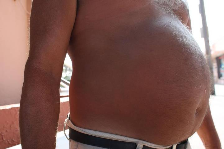 New Report Lists Maine as One of America’s Most Overweight