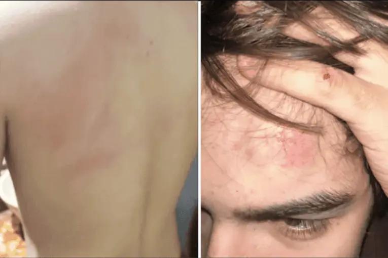 Adolescente quiso rescatar a su perro de una pelea y lo golpearon con una pala