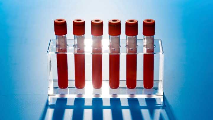 'Exciting' New Cancer Blood Test Results Hide a Concerning Problem