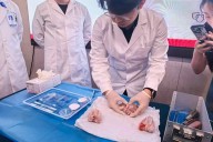 Científicos chinos crean adhesivo biológico que une huesos en 3 minutos