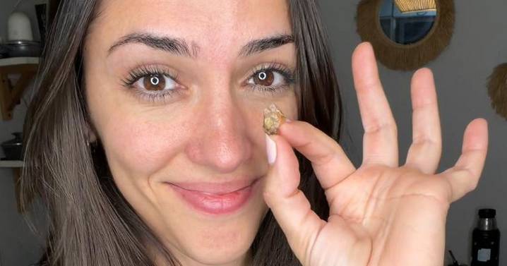 Doctors find tape inside mum's nose that may have been there from birth