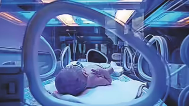 hlMumbai miracle: 350-gram ‘Nano Preemie’ becomes India’s smallest surviving infant