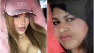 El origen de la transformación extrema y las cirugías: el crudo relato de la “Barbie Colombiana” tras sufrir bullying