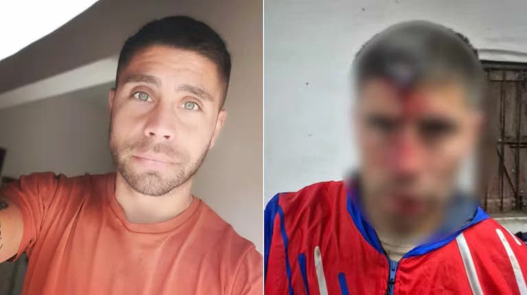 Le dieron el alta al hombre que fue apuñalado en la cabeza con una llave de auto en Berazategui