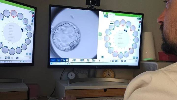 Logran un embarazo con un método que recupera esperma con Inteligencia Artificial