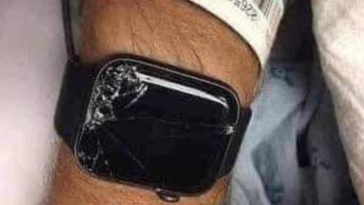 Apple Watch Saves Man’s Life After Serious Accident, Alerts Son: ‘Your Father Met With Accident...’