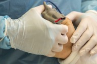 “Para tener la menor cantidad de trabajo posible”: enfermero mató a 11 pacientes y realizó otros 27 intentos