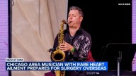 Chicago-area musician, Elmhurst University professor Nick Bisesi prepares for surgery in London for rare heart condition