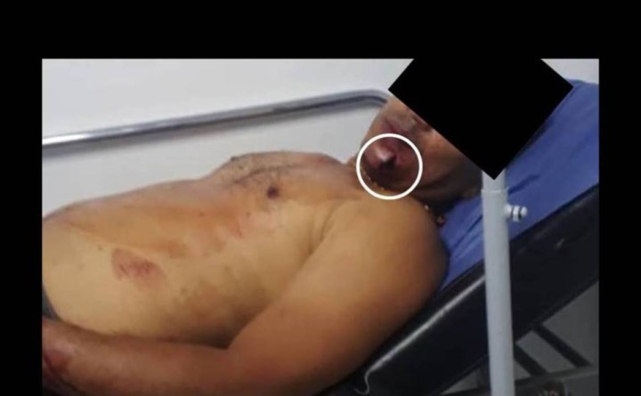 Disparan a la cara a un PNB en Tucupita y salvan su vida en Maturín