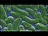 Case of 'Flesh-eating bacteria' reported in Polk County, Florida Department of Health say