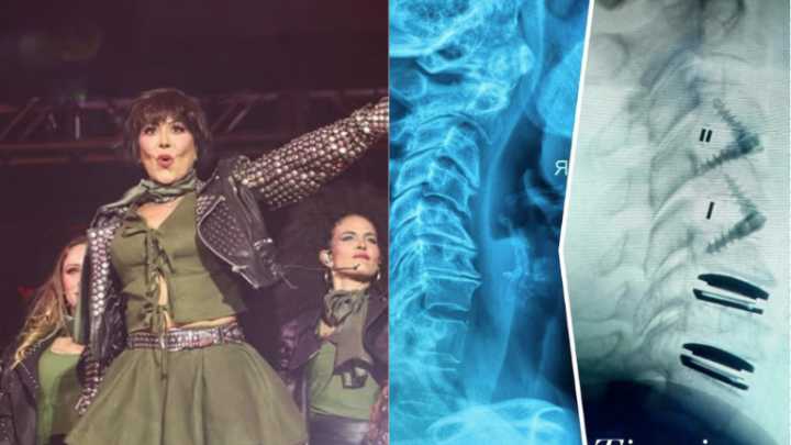 Muestra Alejandra Guzmán la radiografía de su columna tras delicada cirugía