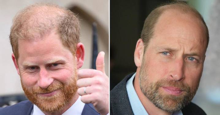 Prince Harry Admits He's Going Bald After Mocking Brother's Lack of Hair