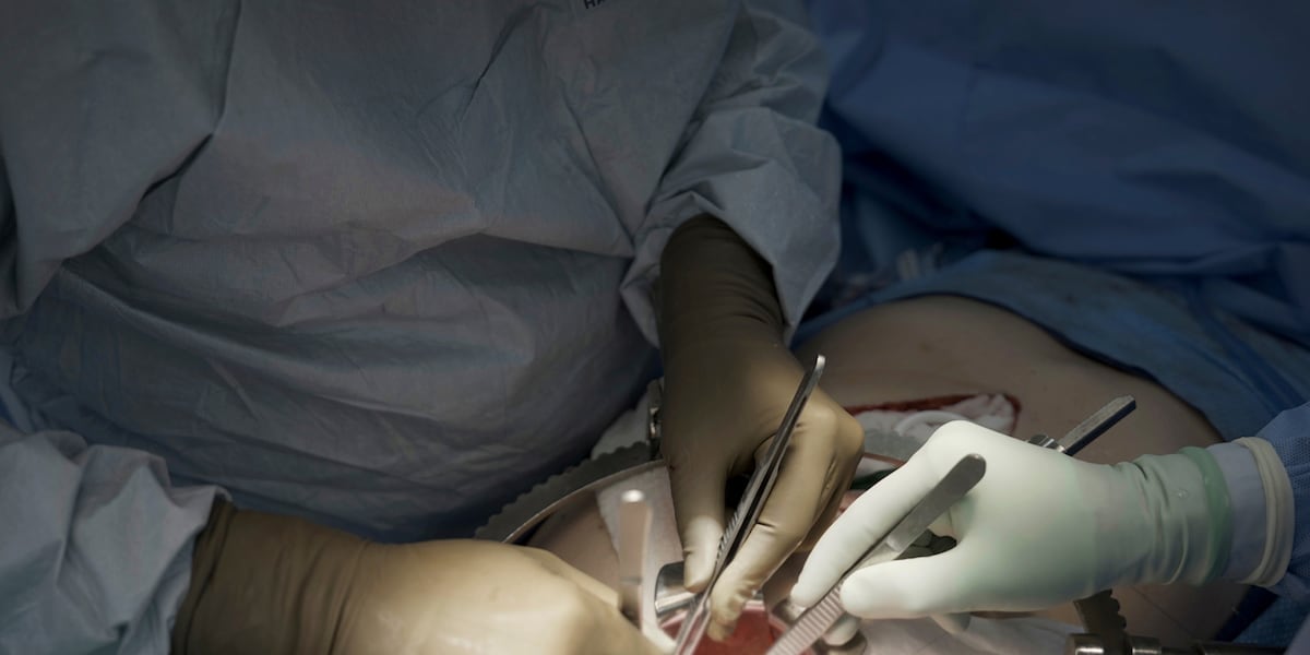 First clinical trial of pig kidney transplants gets underway