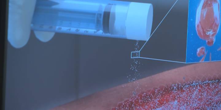 Burn surgeons use spray-on skin technology for faster healing