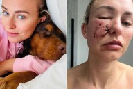 Dog Owner Says Her Cocker Spaniel Attacked Her Face Unprompted: ‘So Shocked’