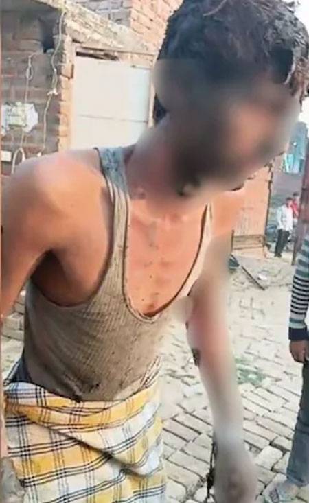 Youth set on fire after dispute over prayer space in Badaun Mosque