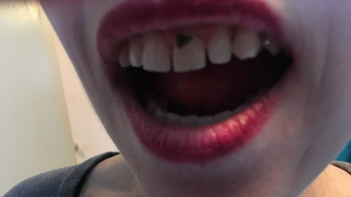 Mennonite Woman Walks Around All Day with Kale in Her Teeth